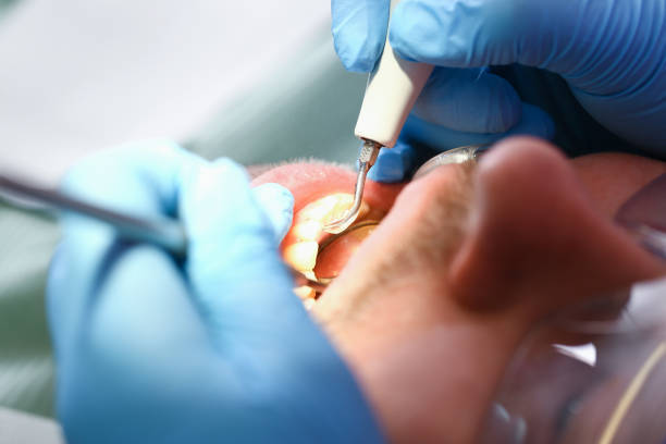 Best Walk-In Emergency Dental Services in Rockwall, TX